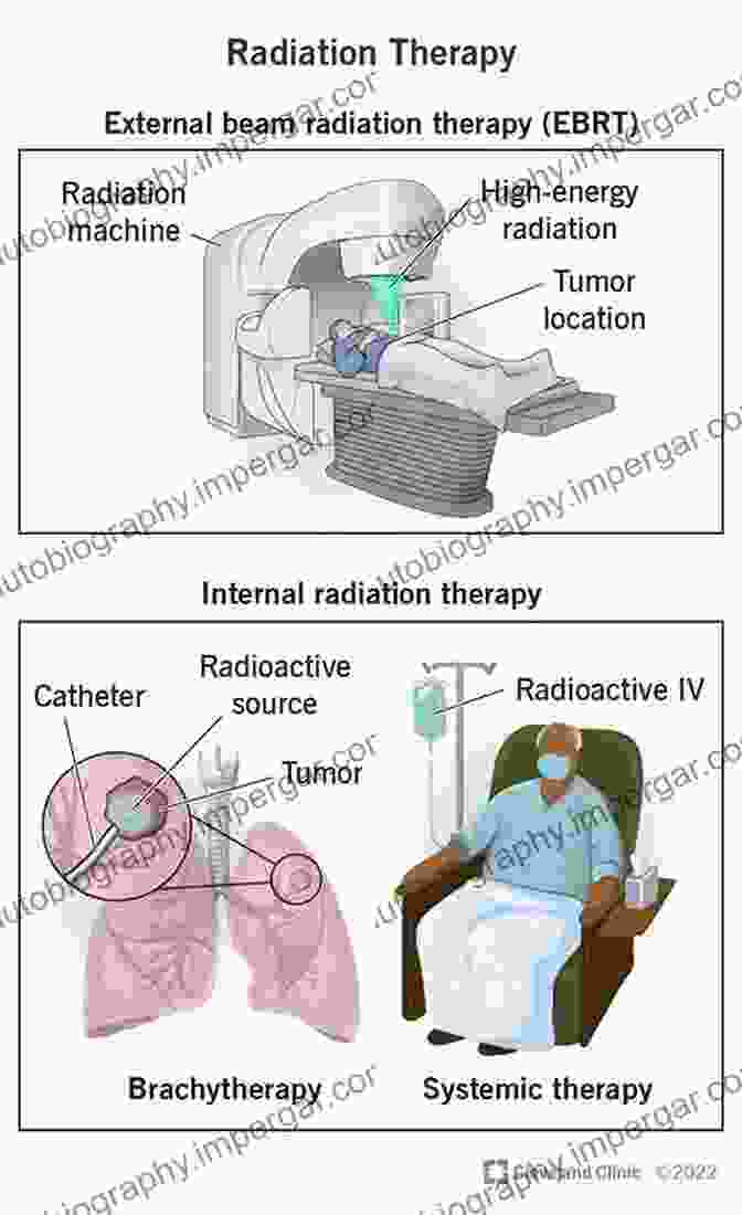 Radiation Therapy Harnesses The Power Of Ionizing Radiation To Target And Eliminate Cancerous Cells Advanced MR Neuroimaging: From Theory To Clinical Practice (Series In Medical Physics And Biomedical Engineering)