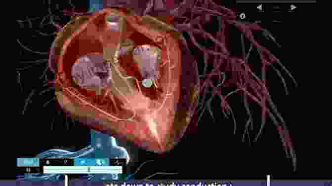 Simulation Of A Beating Heart Computational Modeling In Biomedical Engineering And Medical Physics