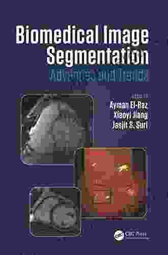 Biomedical Image Segmentation: Advances And Trends