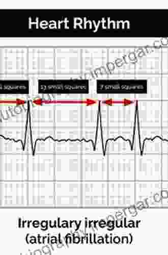 E Z Rhythm Interpretation