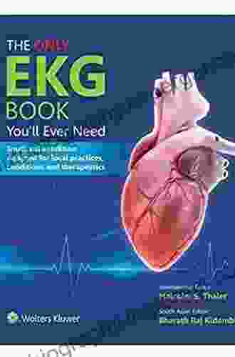 The Only EKG You Ll Ever Need (Only Ekg Youll Ever Need)